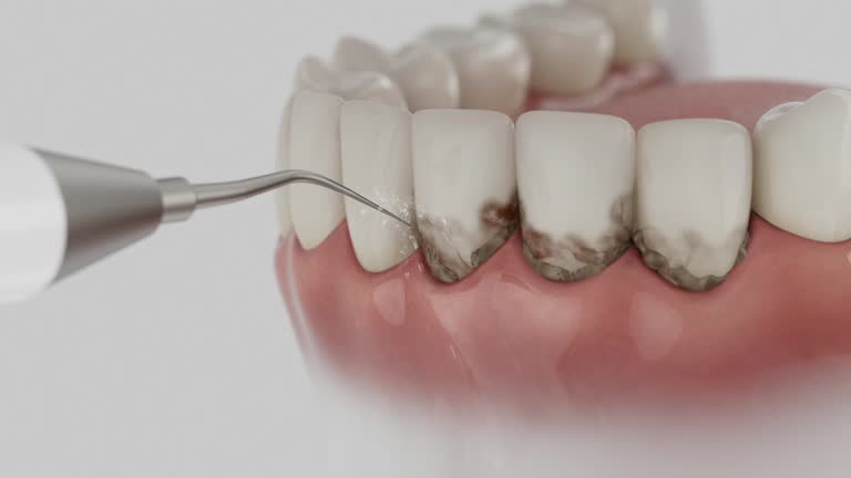Reliable Dental Implants contractor in Prudhoe Bay, AK by Smile Center Dentistry